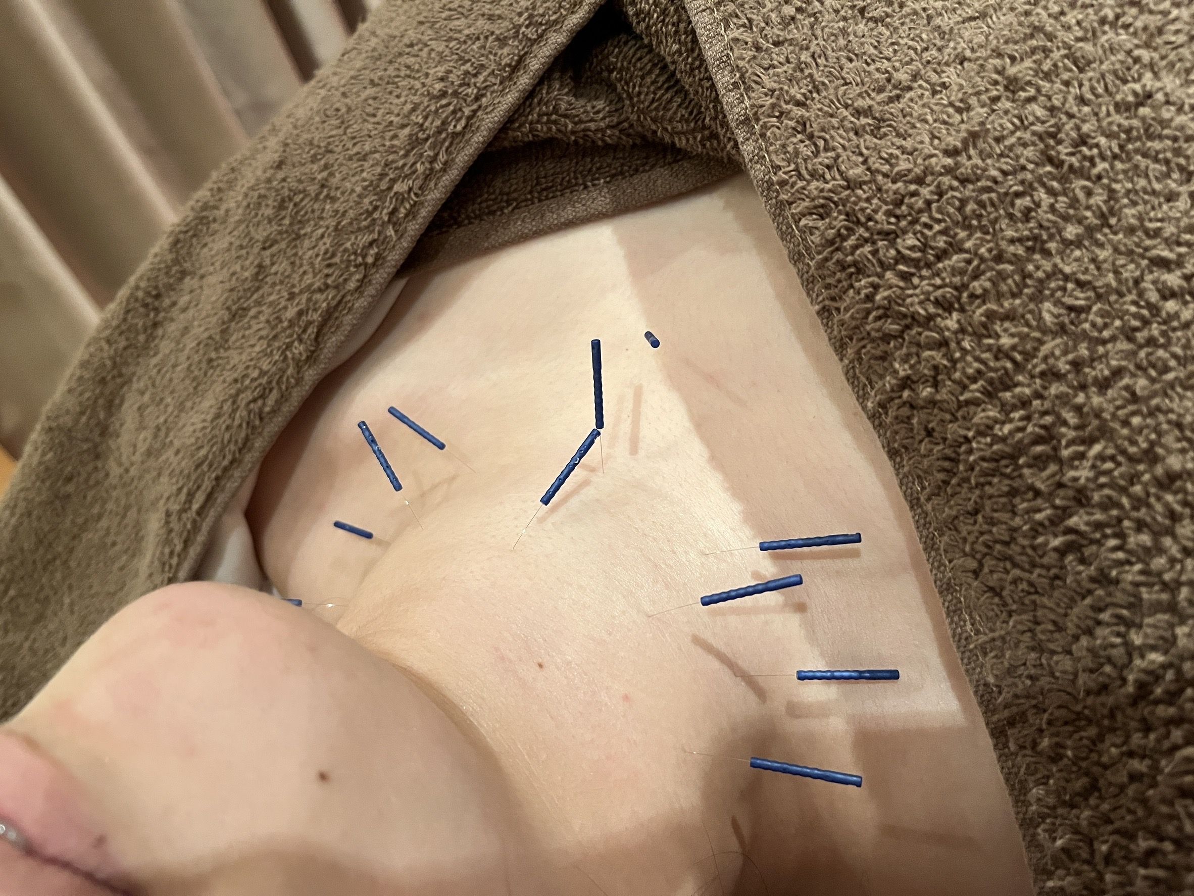 line_oa_chat_250317_112240