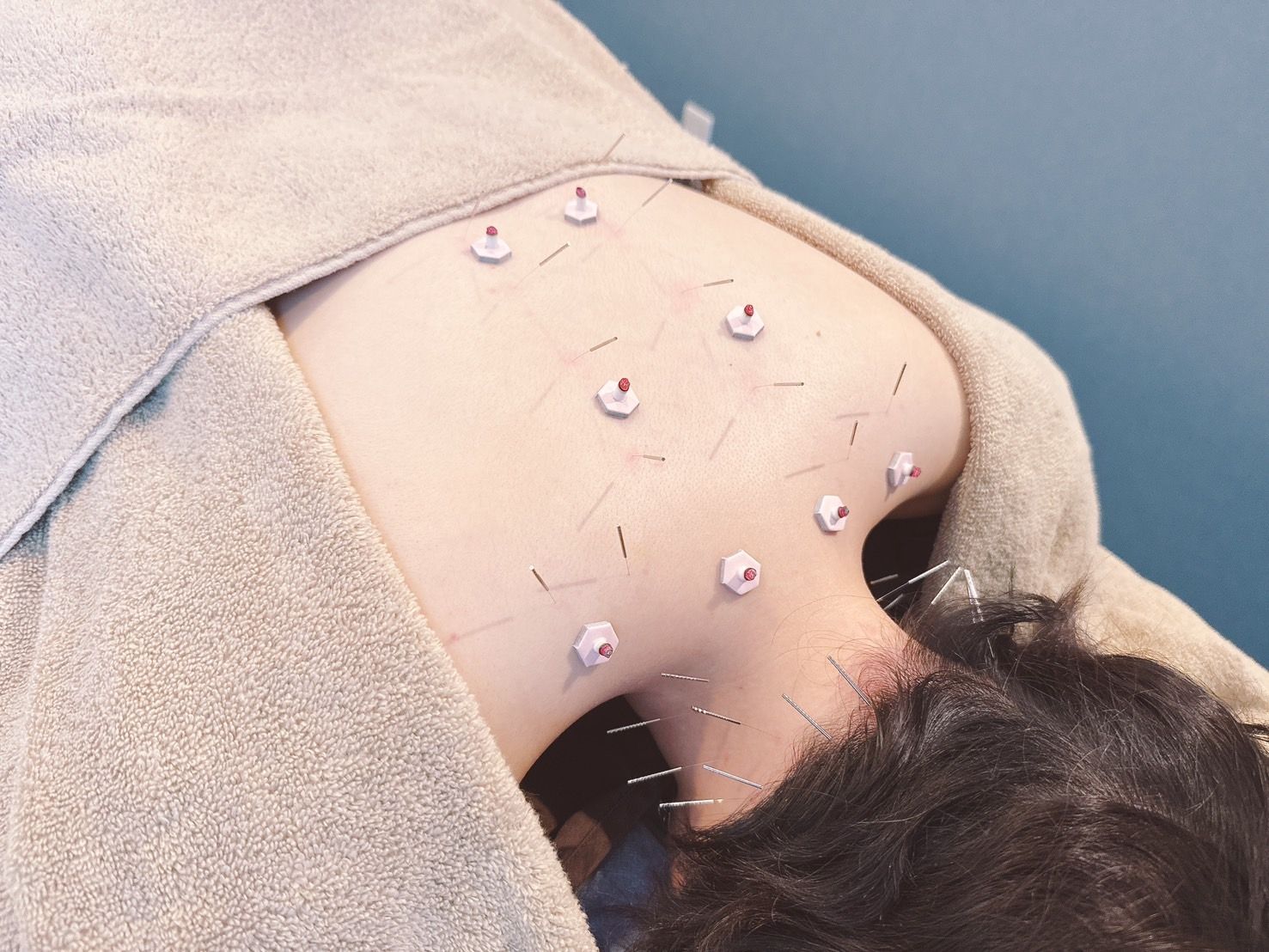 line_oa_chat_250801_135420_8