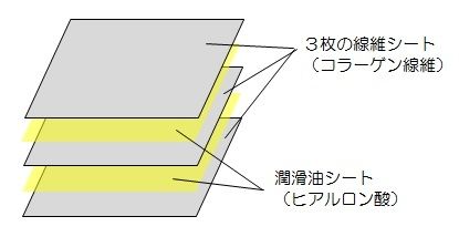 筋膜模式図①