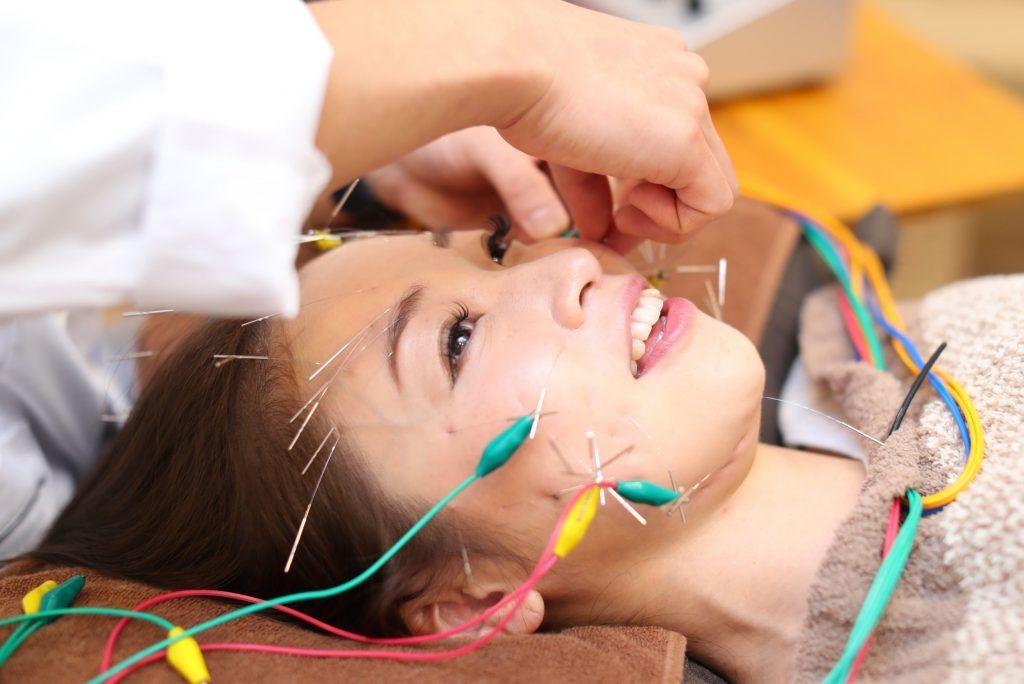 施術メニュー:電気を流す美容鍼