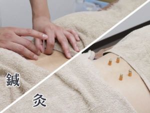 施術メニュー:鍼灸（お悩みの症状に特化）