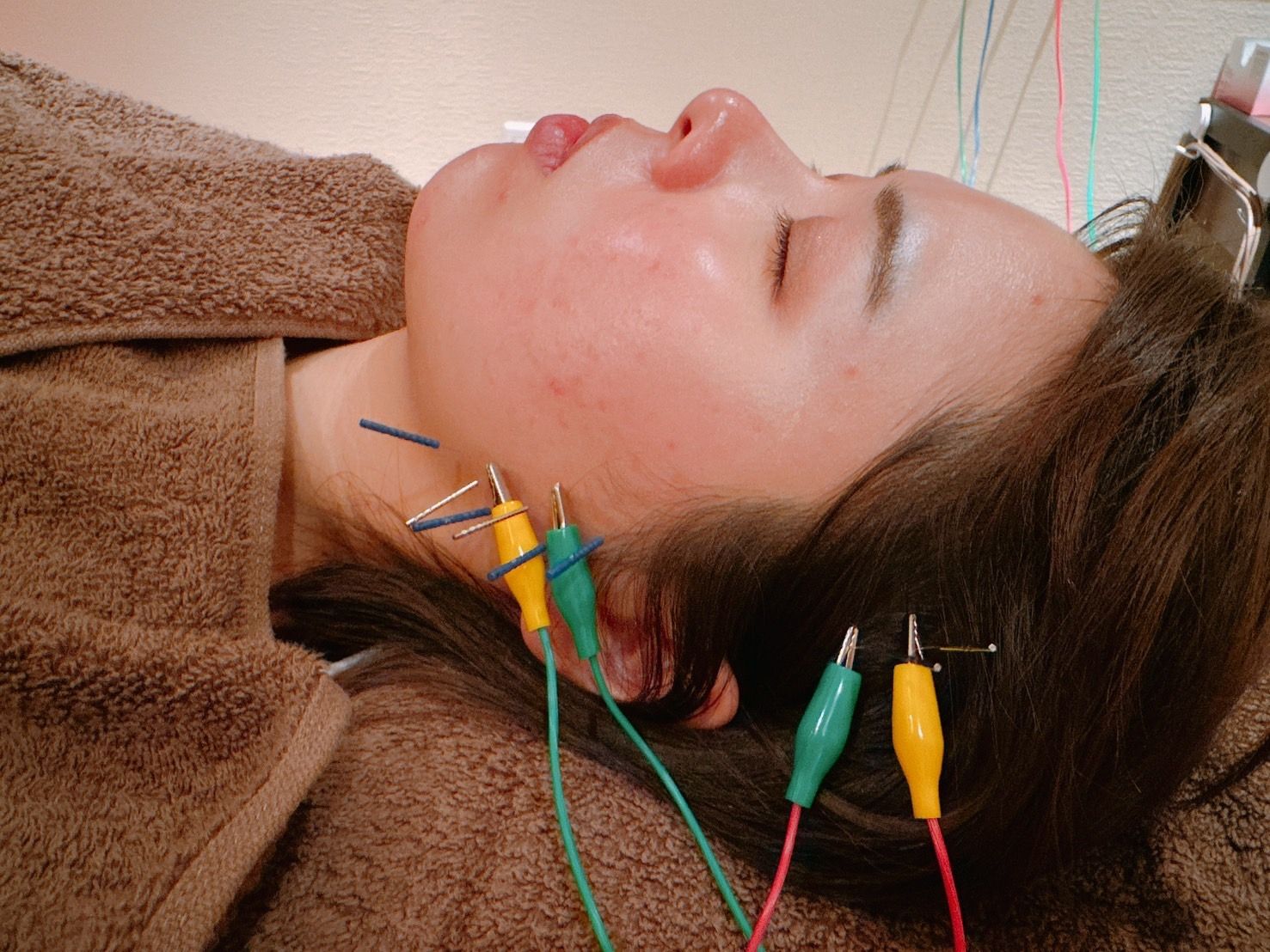 line_oa_chat_250318_135650_2