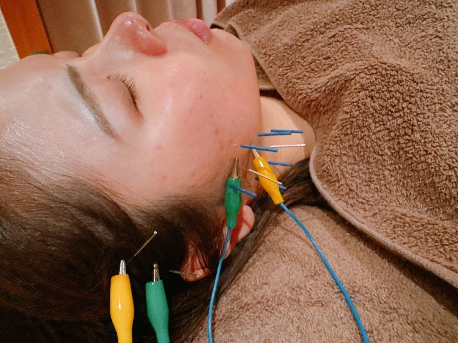 line_oa_chat_250318_135652