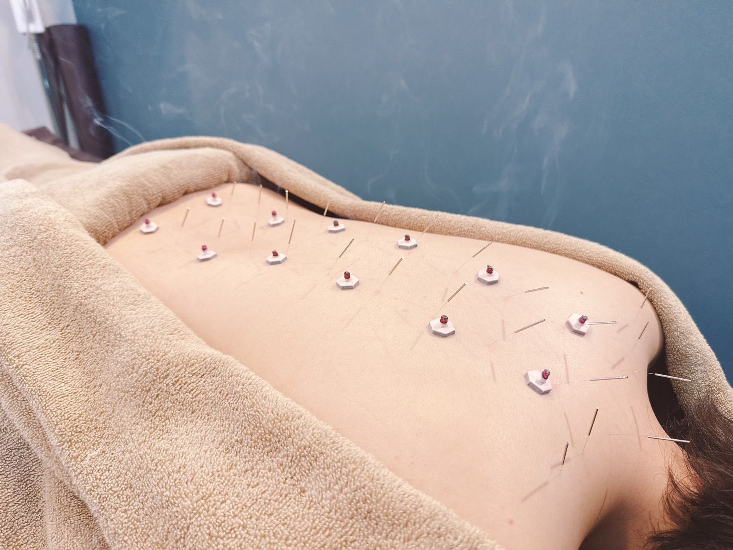 line_oa_chat_250801_134312_1