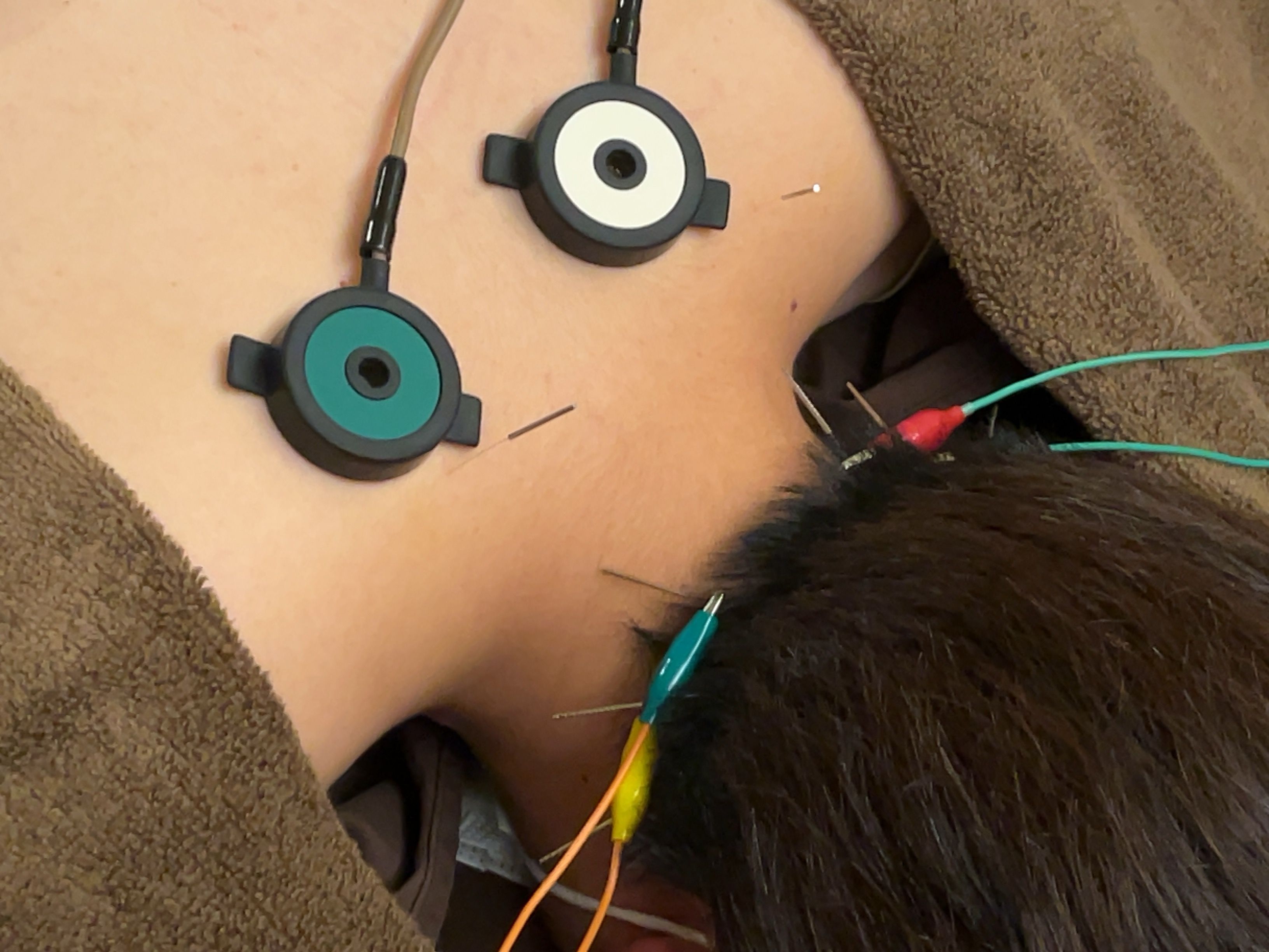 首のパルス+肩の温灸器